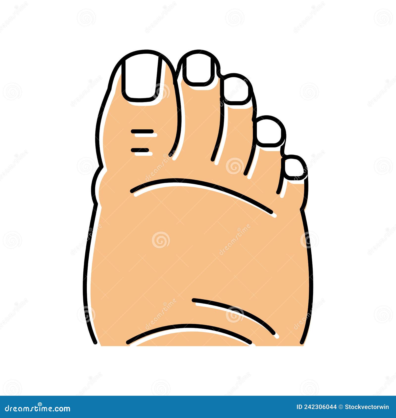 Fatty Foot Edema Color Icon Vector Illustration Stock Vector ...