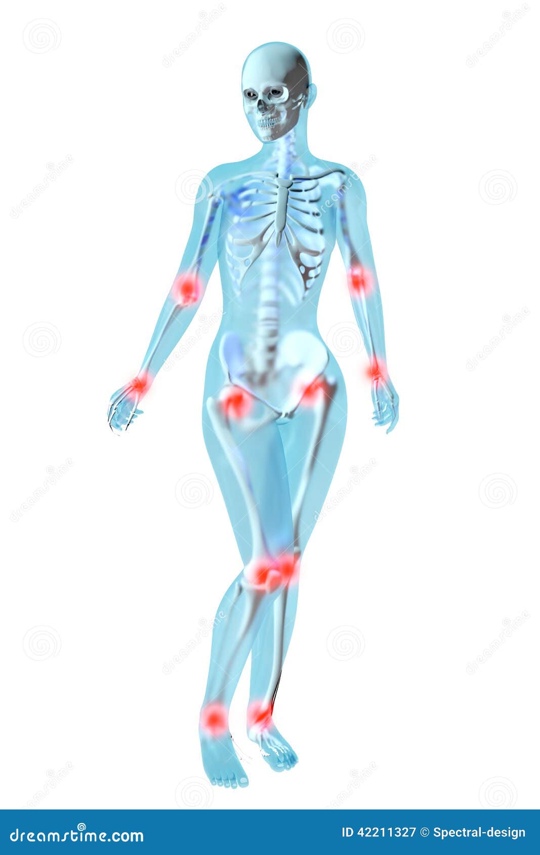 Female Anatomy Joint Ache Stock Illustration Illustration of aching
