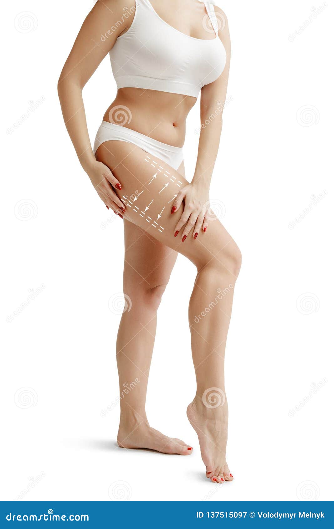 Woman grabbing skin on her flanks with black color crosses marking, Lose  weight and liposuction cellulite removal concept, Isolated on white  backgroun Stock Photo - Alamy