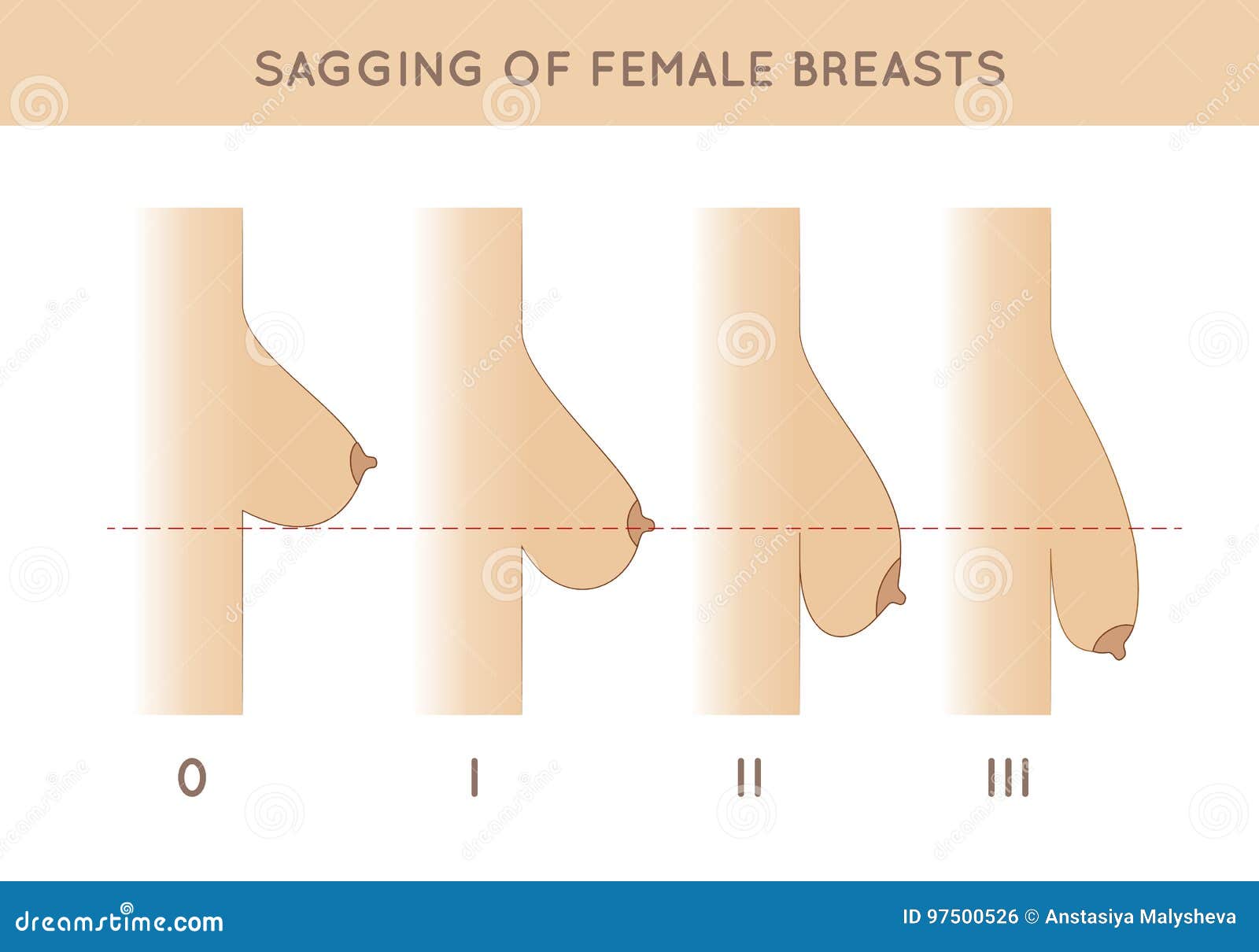 Female breast sagging stock vector. Illustration of girl - 97500526