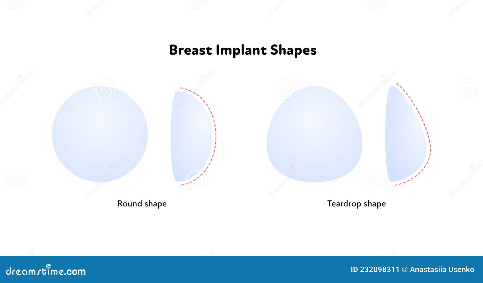 Breast Shape Chart Stock Illustrations – 56 Breast Shape Chart Stock  Illustrations, Vectors & Clipart - Dreamstime