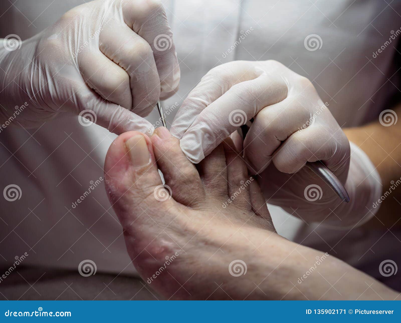 female chiropodist working on a senior clients feet