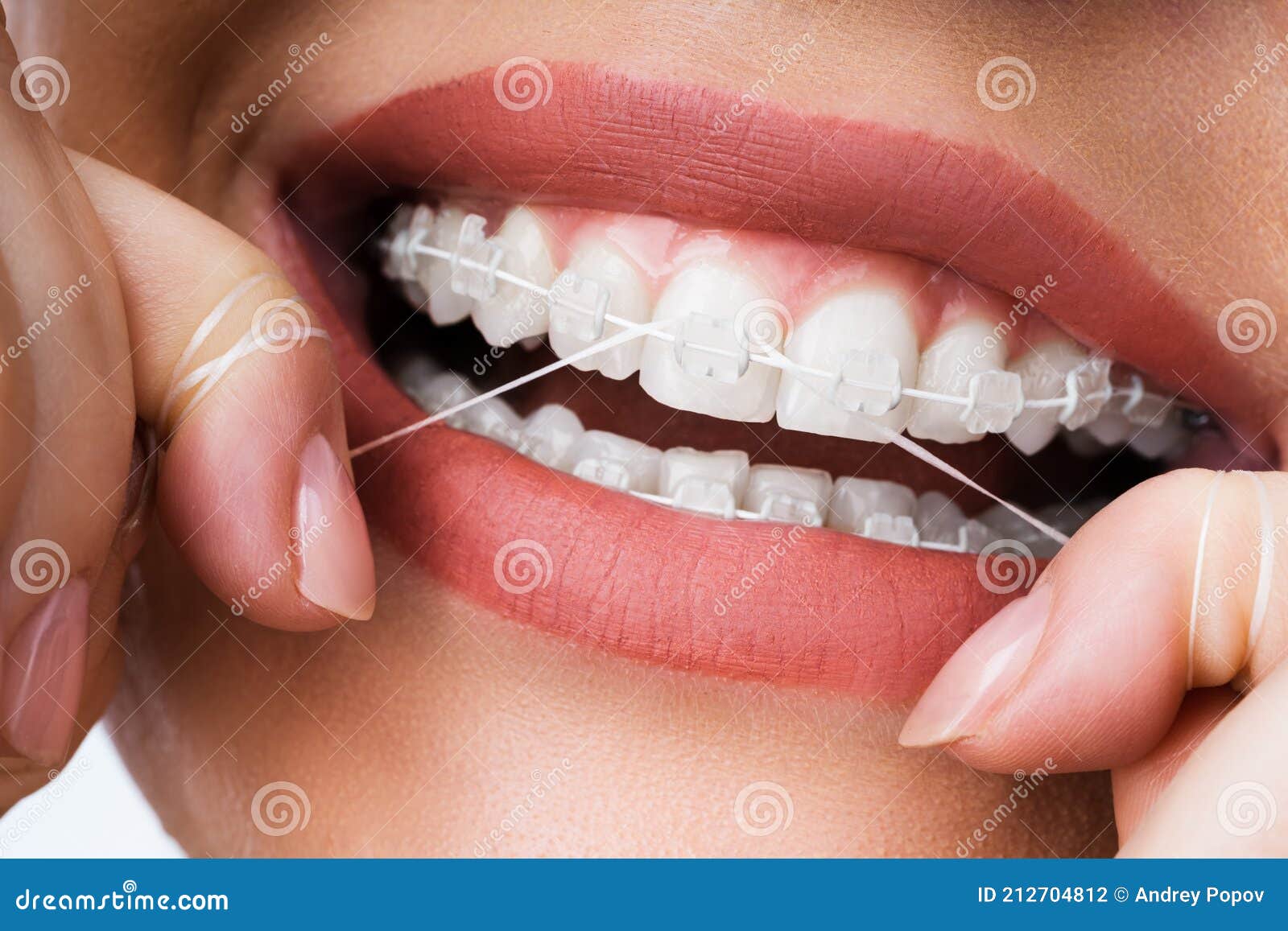 female cleaning dental brackets in mouth