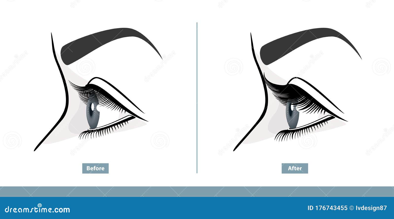 female eye before and after eyelash extension. comparison of natural and volume eyelashes. side view. infographic 