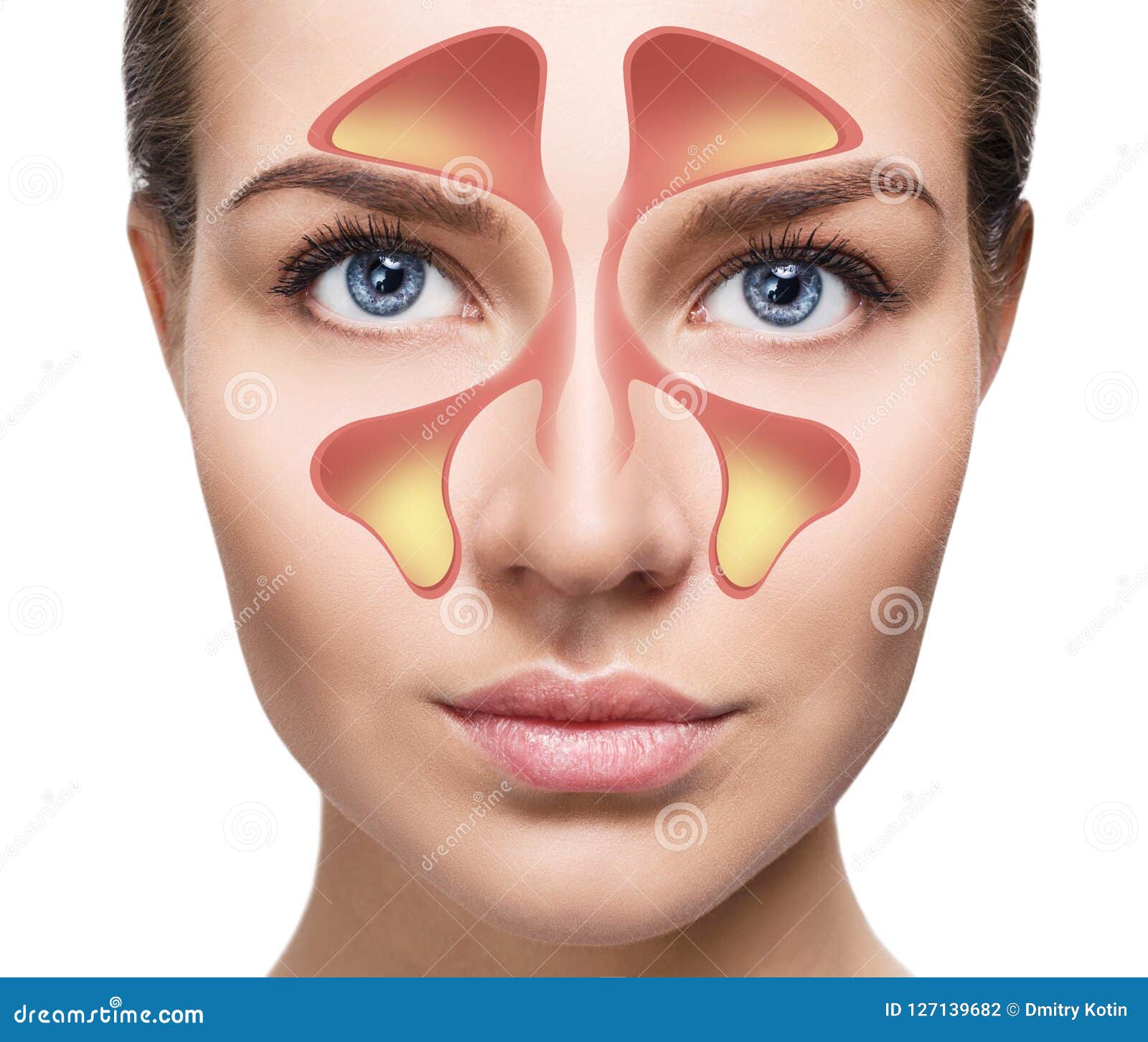 Female Face Shows Nasal Sinus With Cold Over White Background. Stock