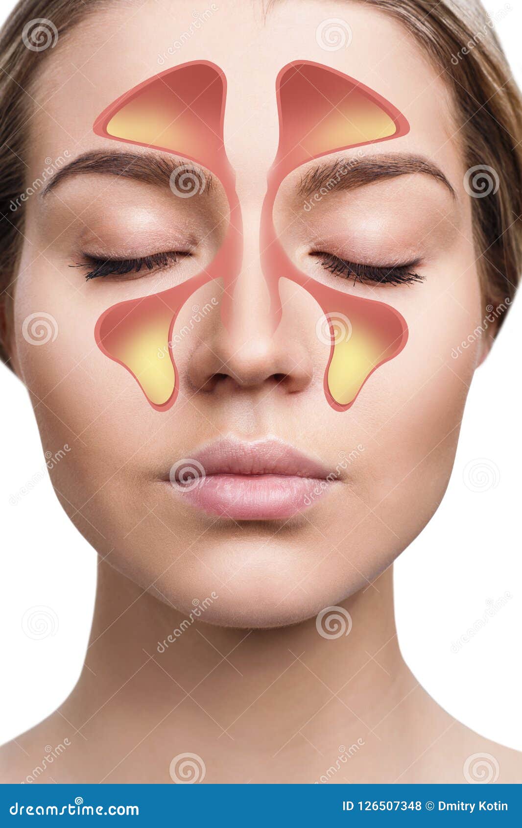 female face shows nasal sinus with cold over white background.
