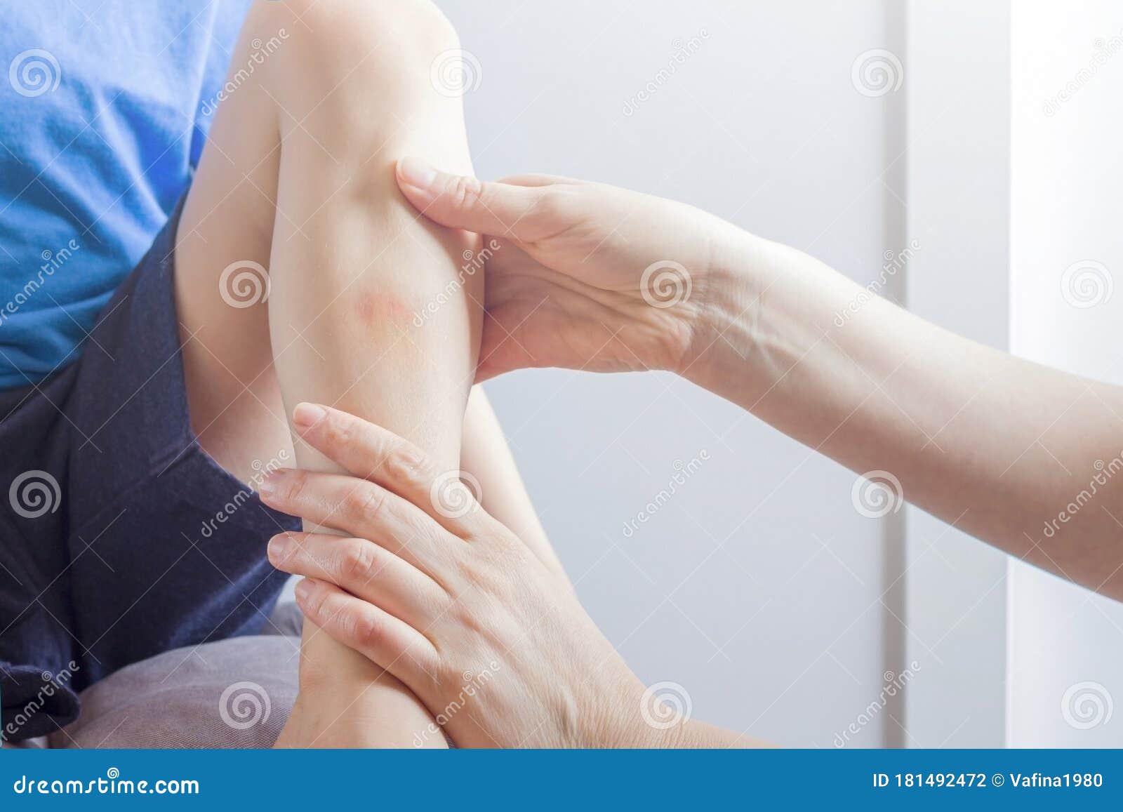 female hand mom or doctor applying ointment on the bruise on leg of child. pain, hematoma. healthcare, ÃÂhildren`s ambulance