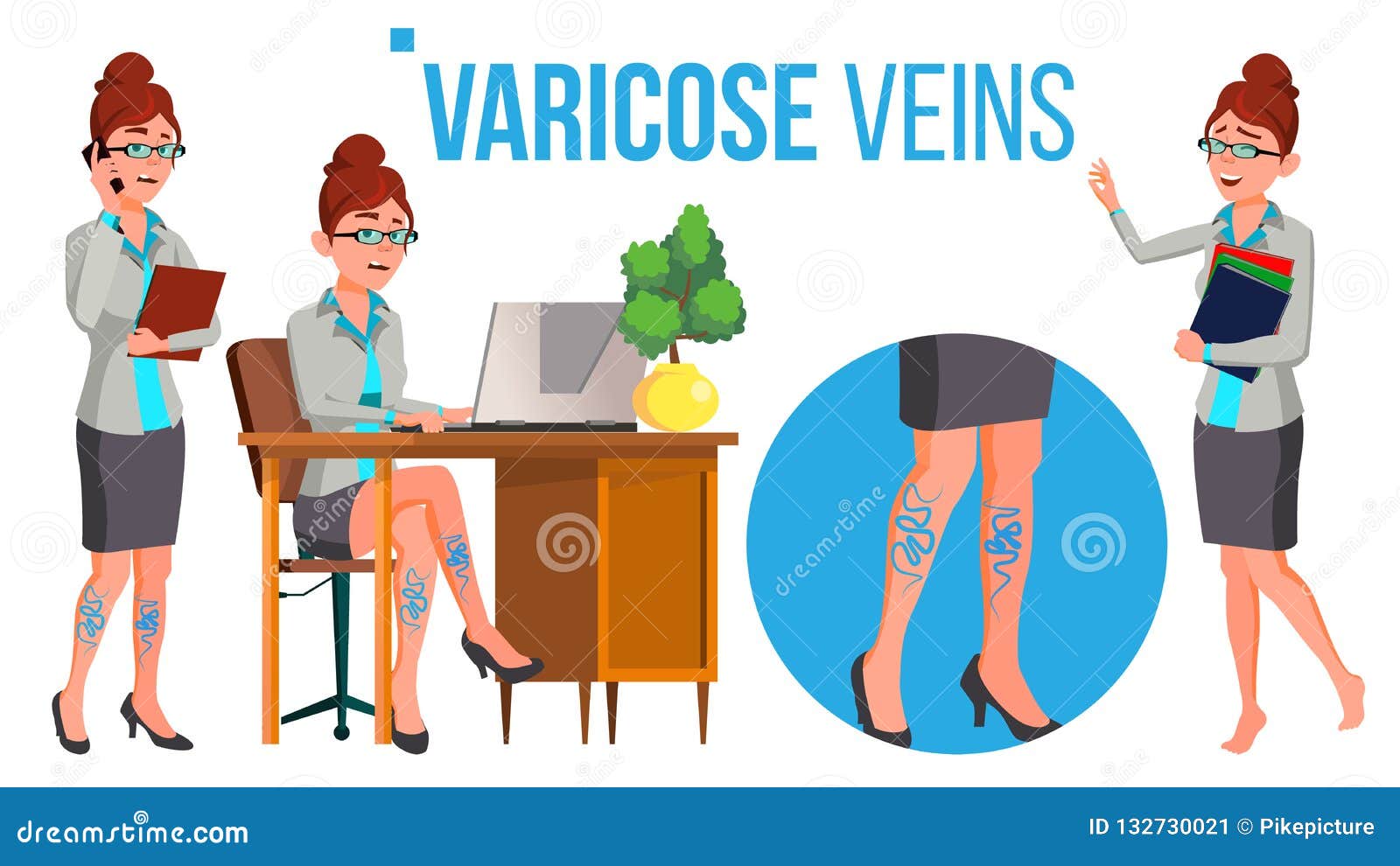 Female Legs in High Heel Shoes with Varicose Veins Vector. Isolated Cartoon  Illustration Stock Vector - Illustration of female, disease: 132730021