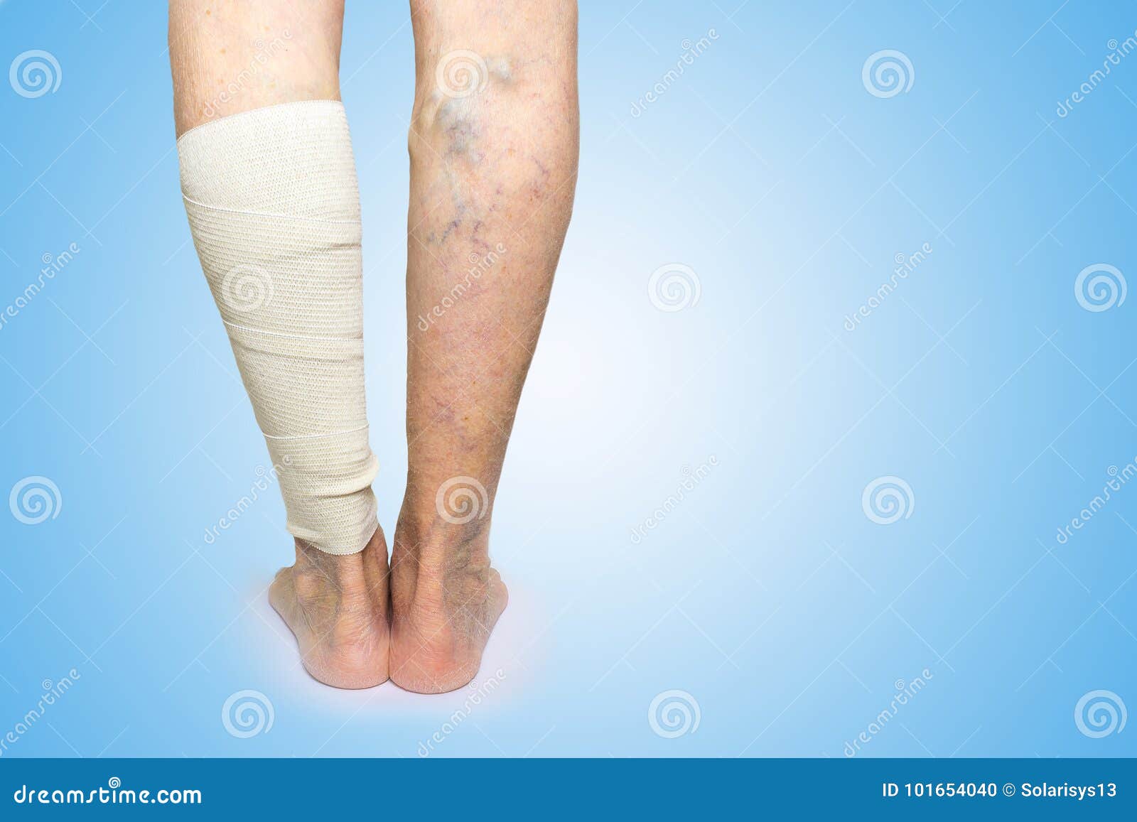 De ce trebuie să vă pansați picioarele cu un bandaj elastic înainte de operație? - Simptome January