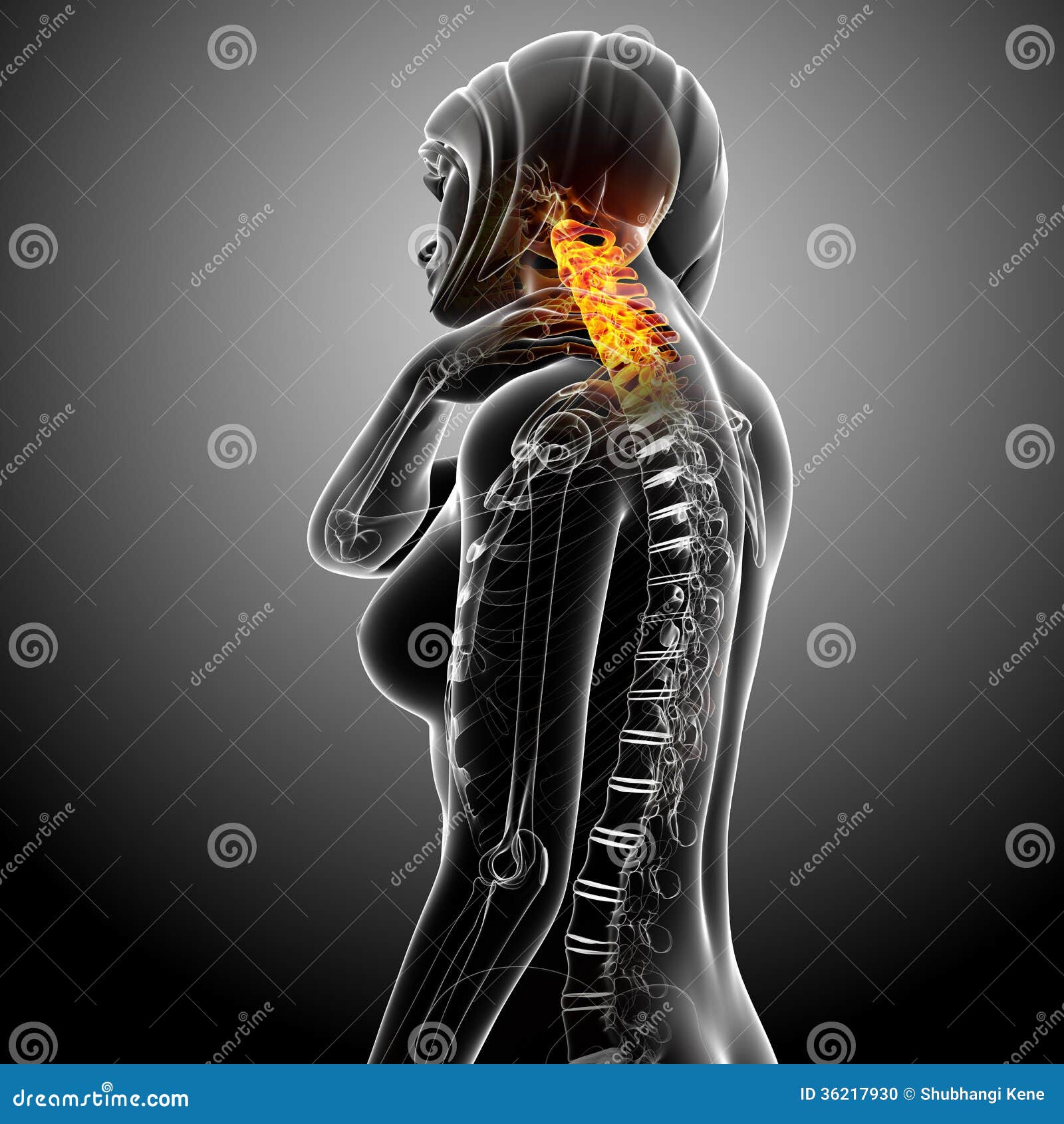 Female neck pain stock illustration. Illustration of graphic - 36217930
