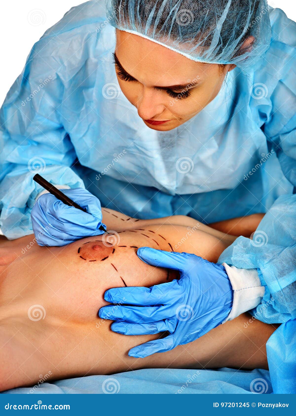 Breast enlarge surgery - Nude pics