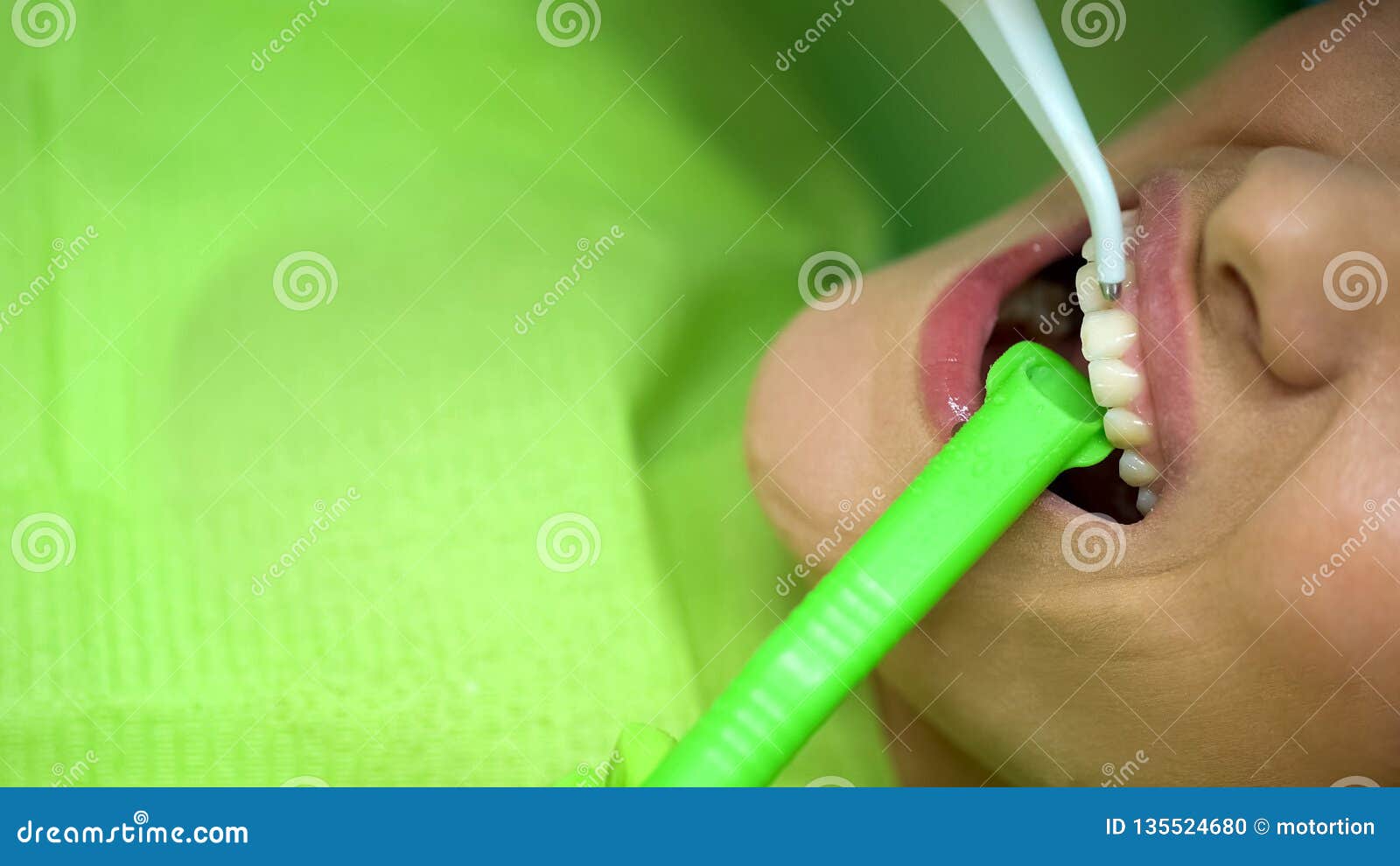 Female Patient At Dentist Chair Procedure Of Bleaching