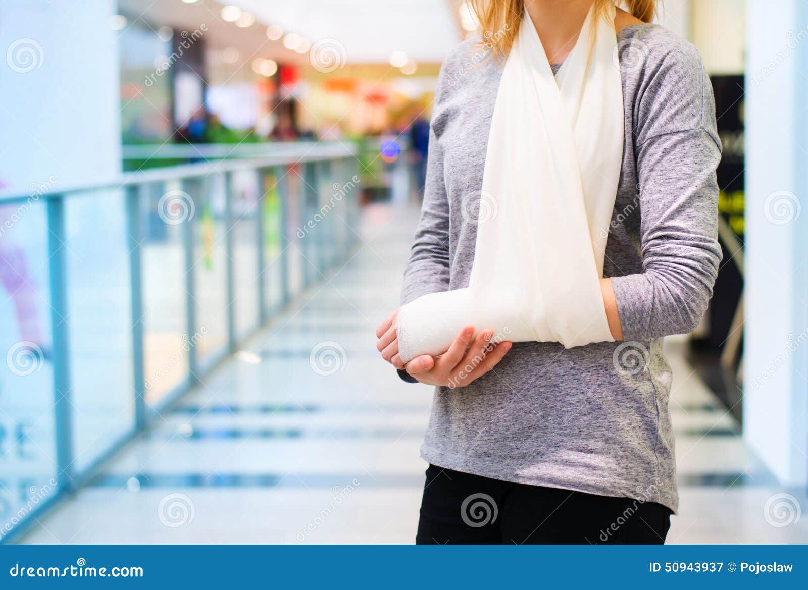 Femme avec le bras cassé image stock. Image du centre 50943937