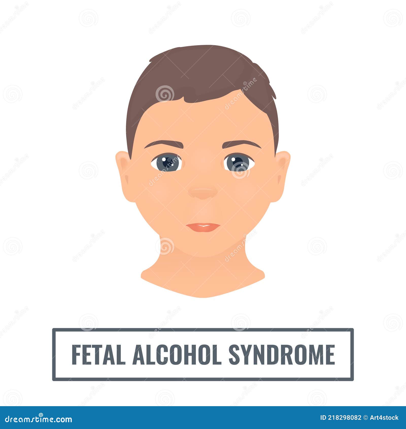 Syndrome fetal alcohol symptoms of Fetal Alcohol