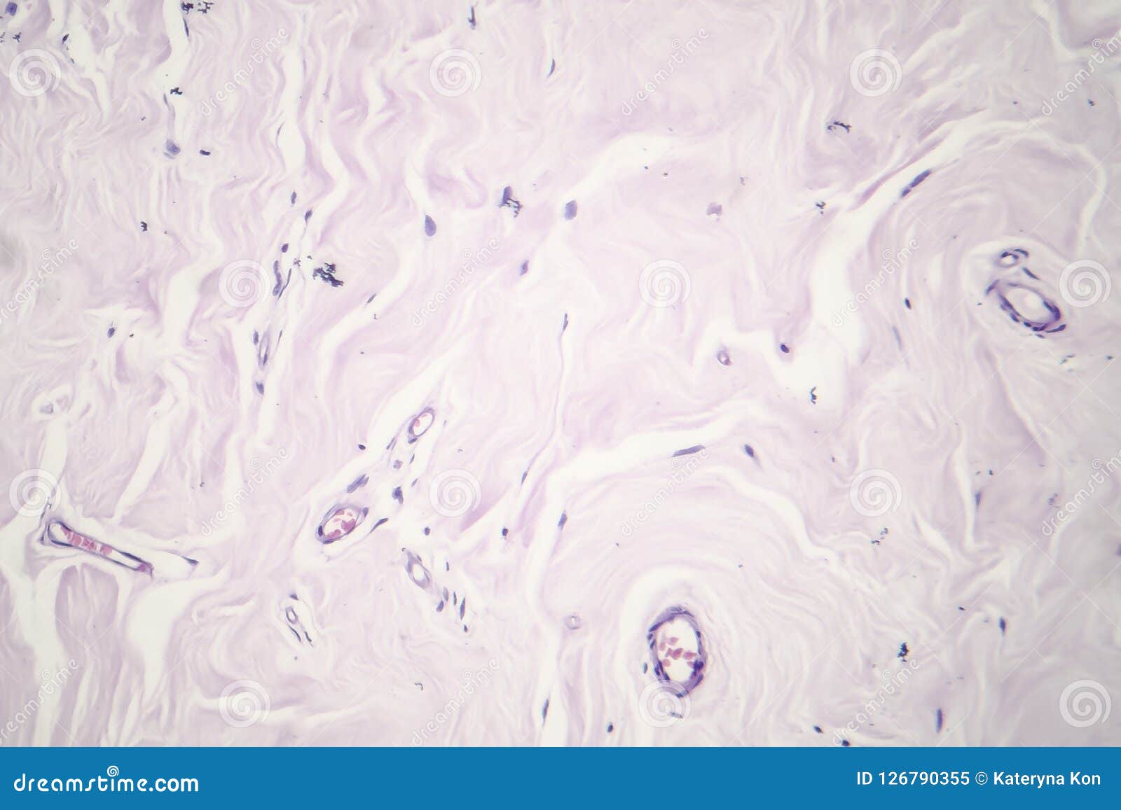 fibroadenoma, light micrograph