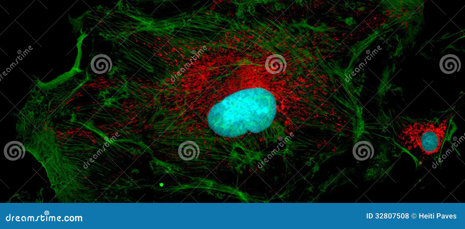 fibroblast cells: big and small