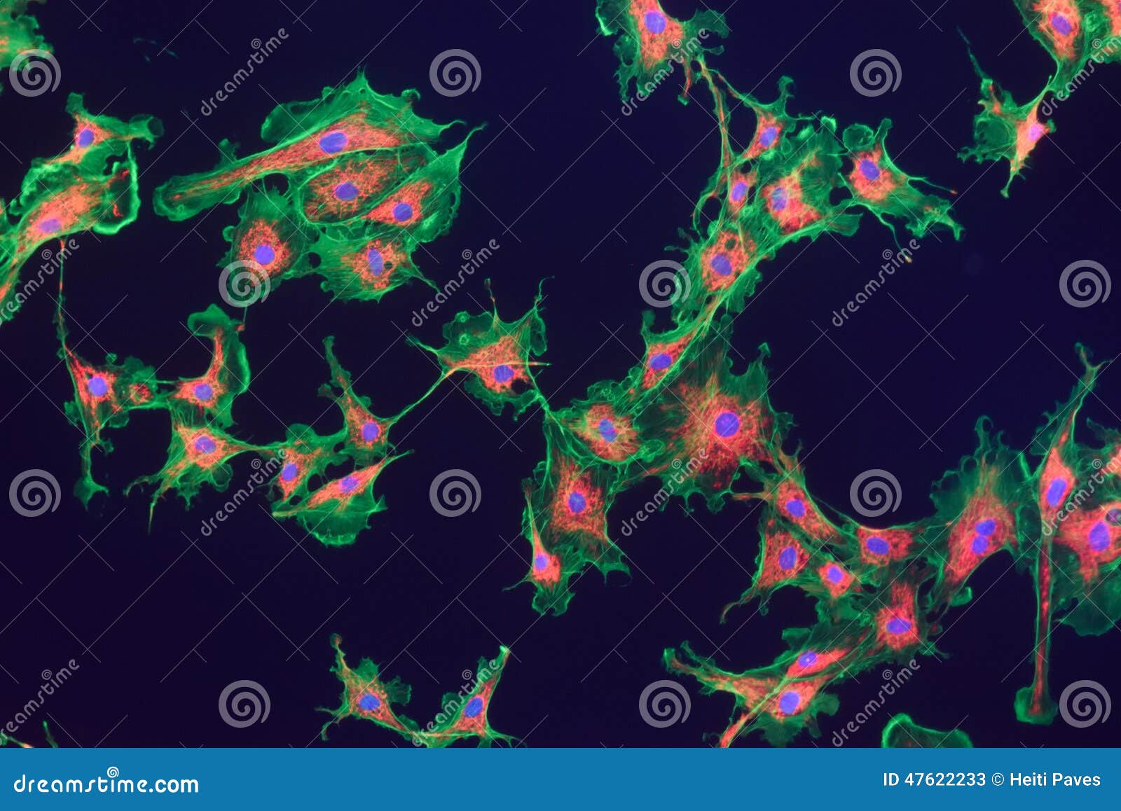 fibroblast cells