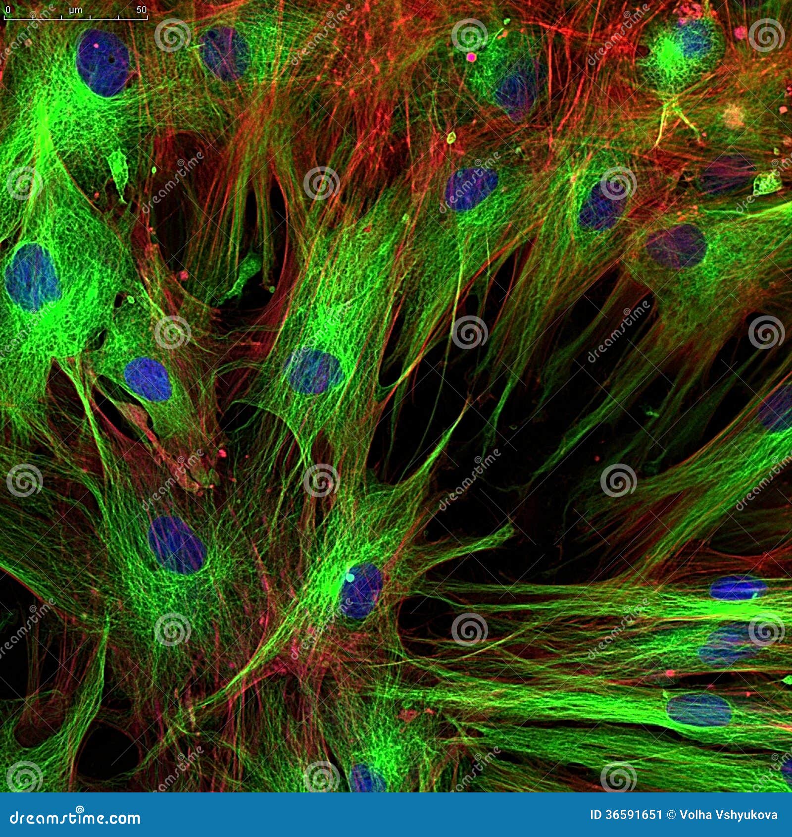 fibroblasts (skin cells) labeled with fluorescent