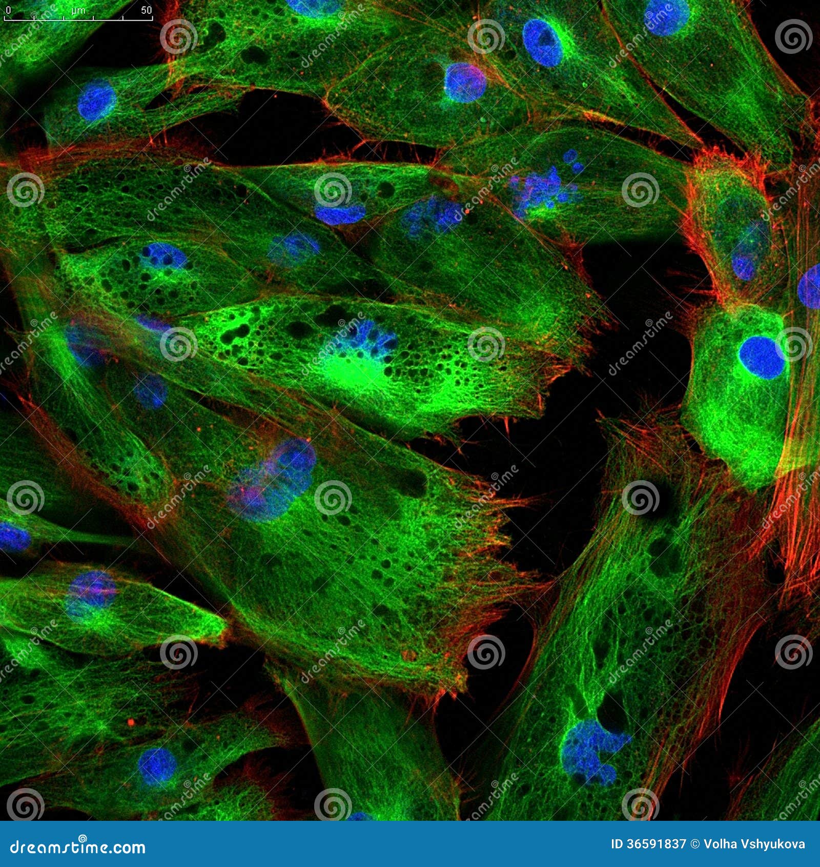 fibroblasts (skin cells) labeled with fluorescent