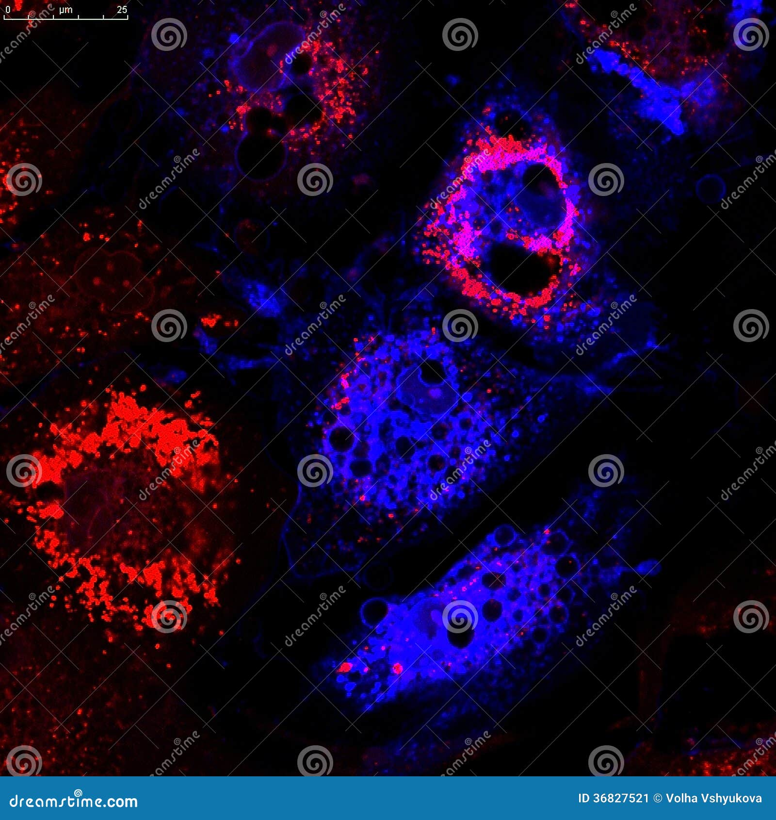 fibroblasts (skin cells) labeled with fluorescent dyes