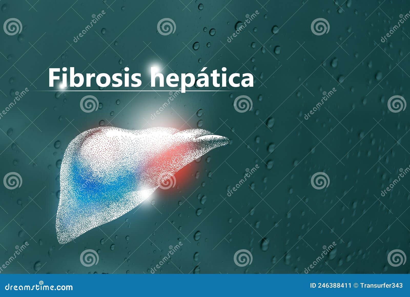 fibrosis hepÃÂ¡tica - diagnÃÂ³stico y tratamiento, lista de comprobaciÃÂ³n mÃÂ©dica. fondo texturizado y espacio de copia vacÃÂ­o para