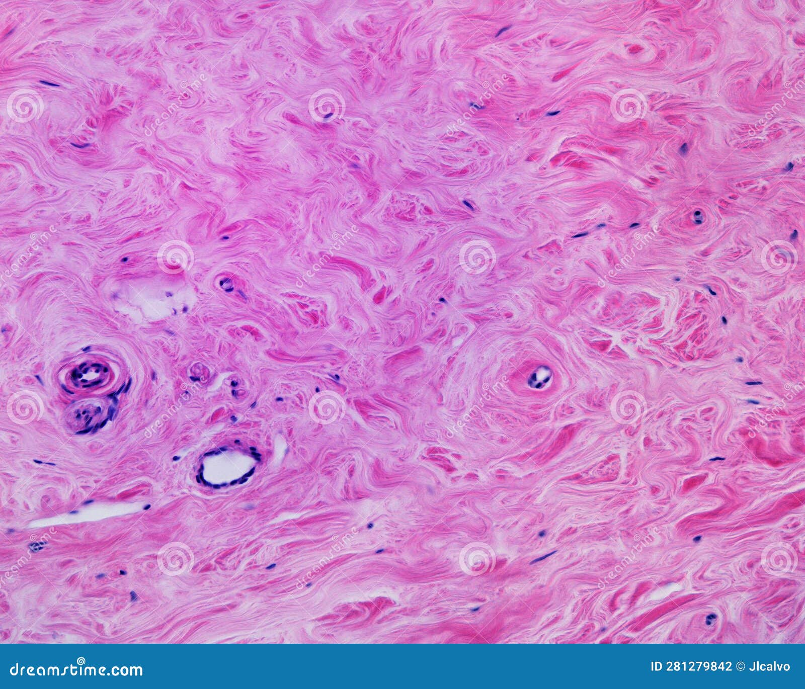 fibrous-connective-tissue-royalty-free-stock-image-cartoondealer