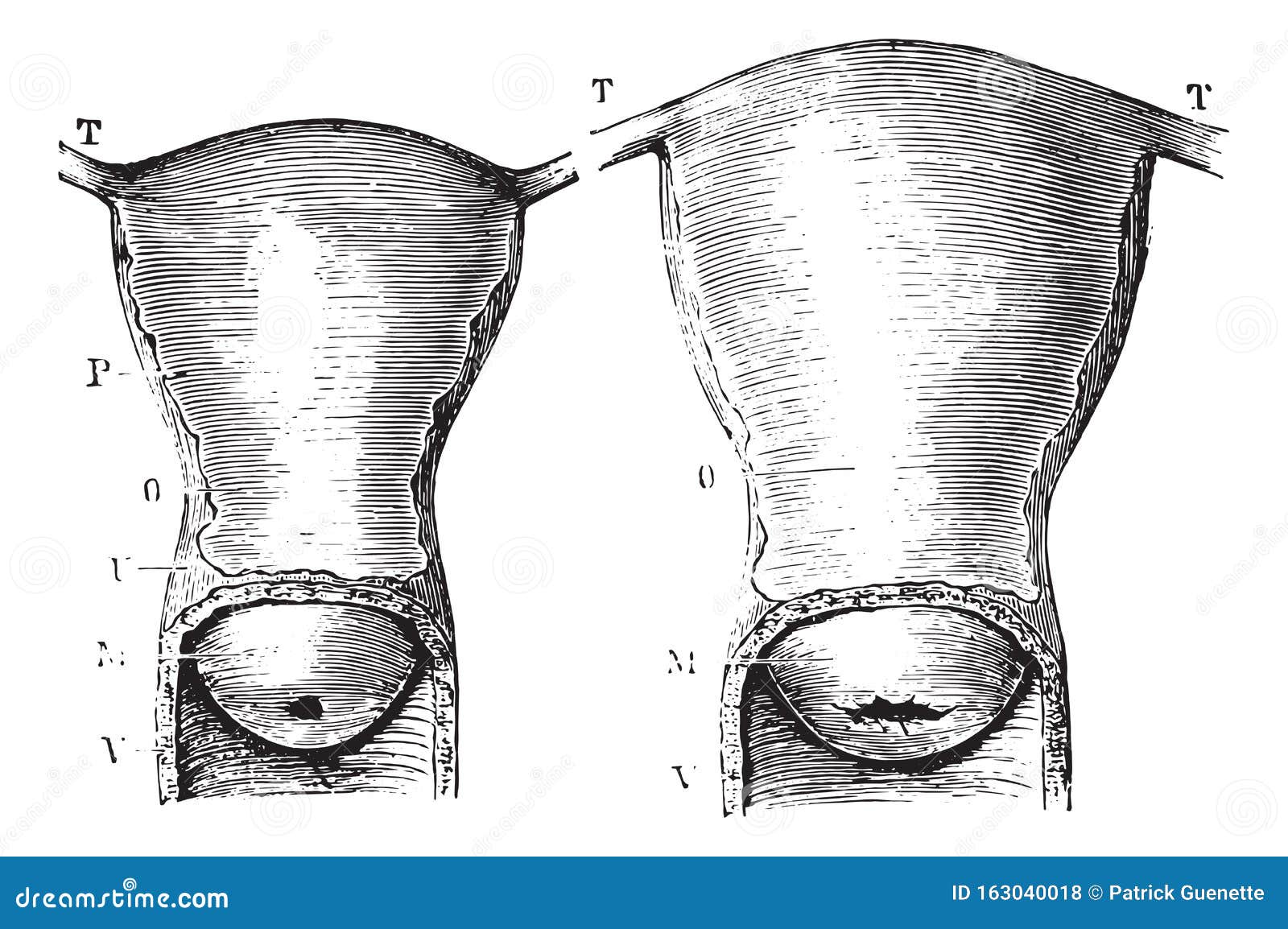 fig. 1229. uterus virgin women, seen by its anterior aspect, fig