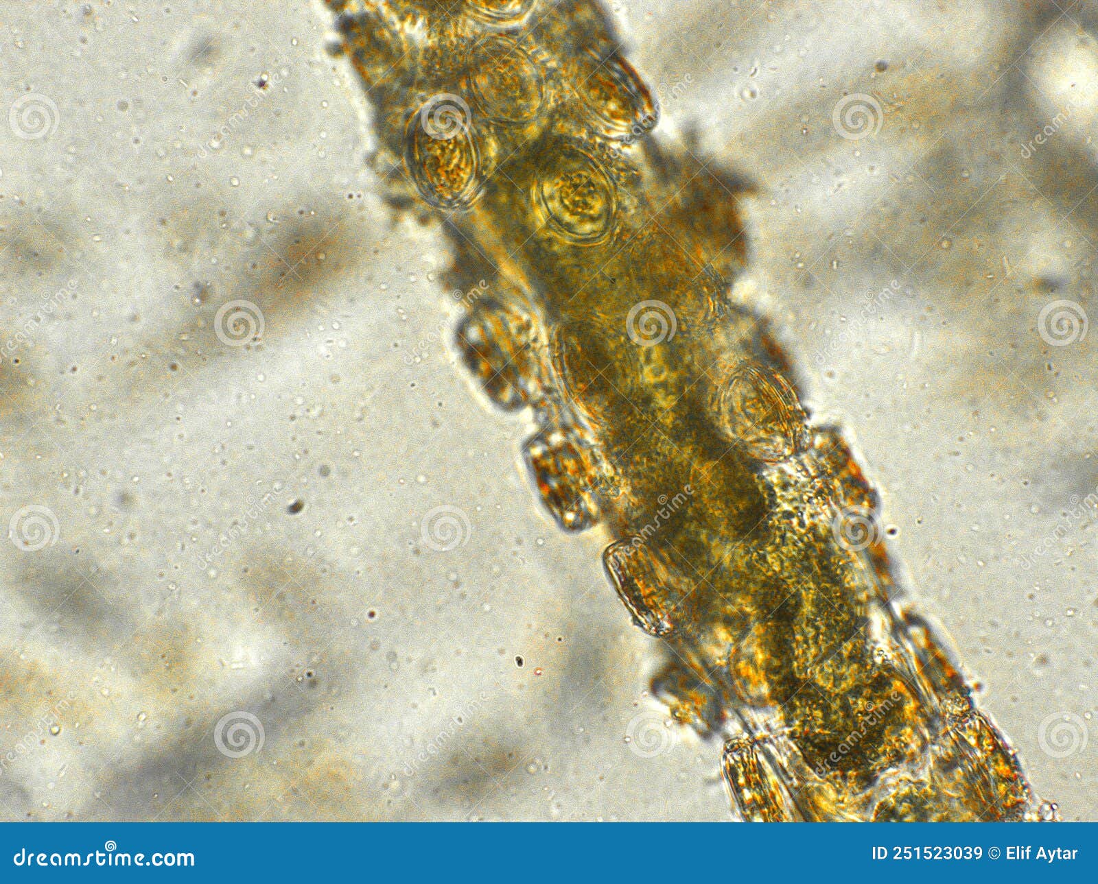 filamentous algae under microscopic view