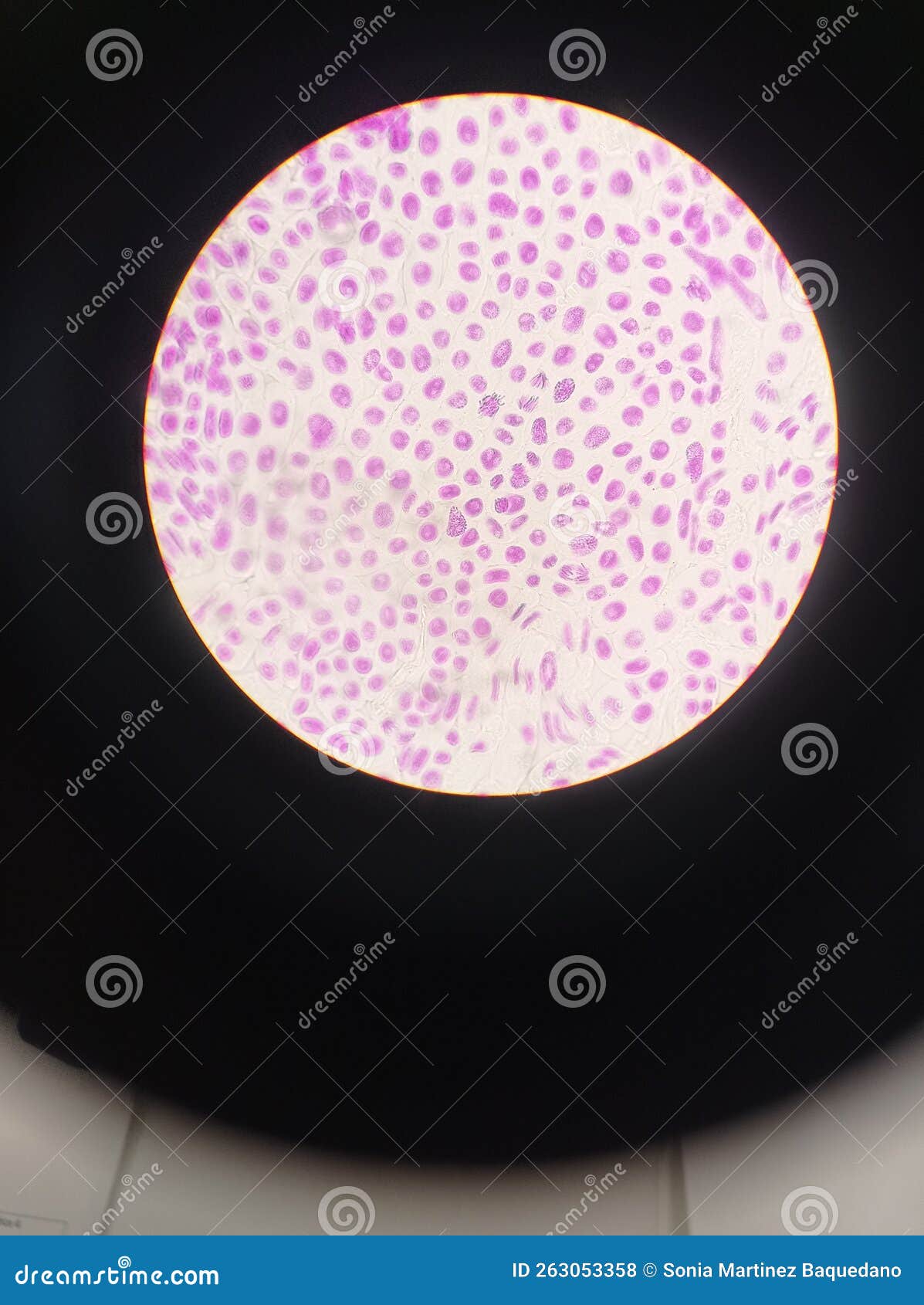 fillament of a cianobacteria with a microscope. cells un mitosis