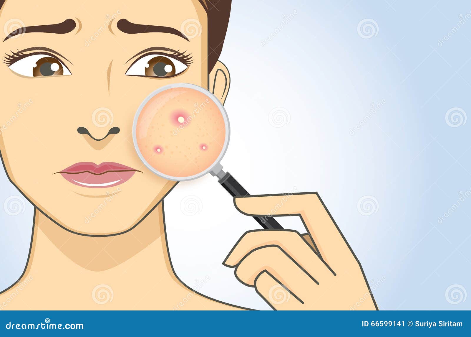 finding acne with magnifier