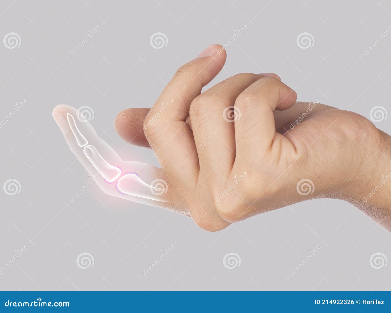 Finger bone pain stock photo. Image of medulla, bones 214922326