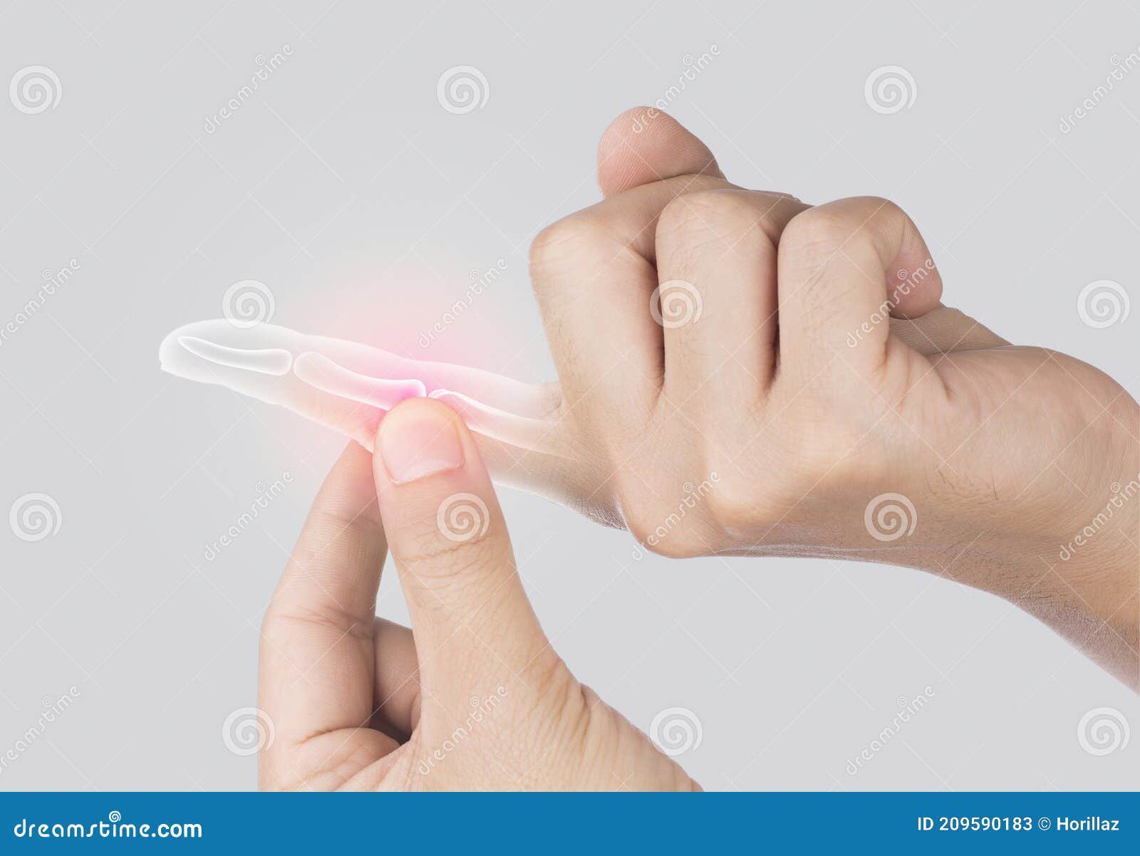 Finger bone pain stock image. Image of finger, osteoarthritis 209590183