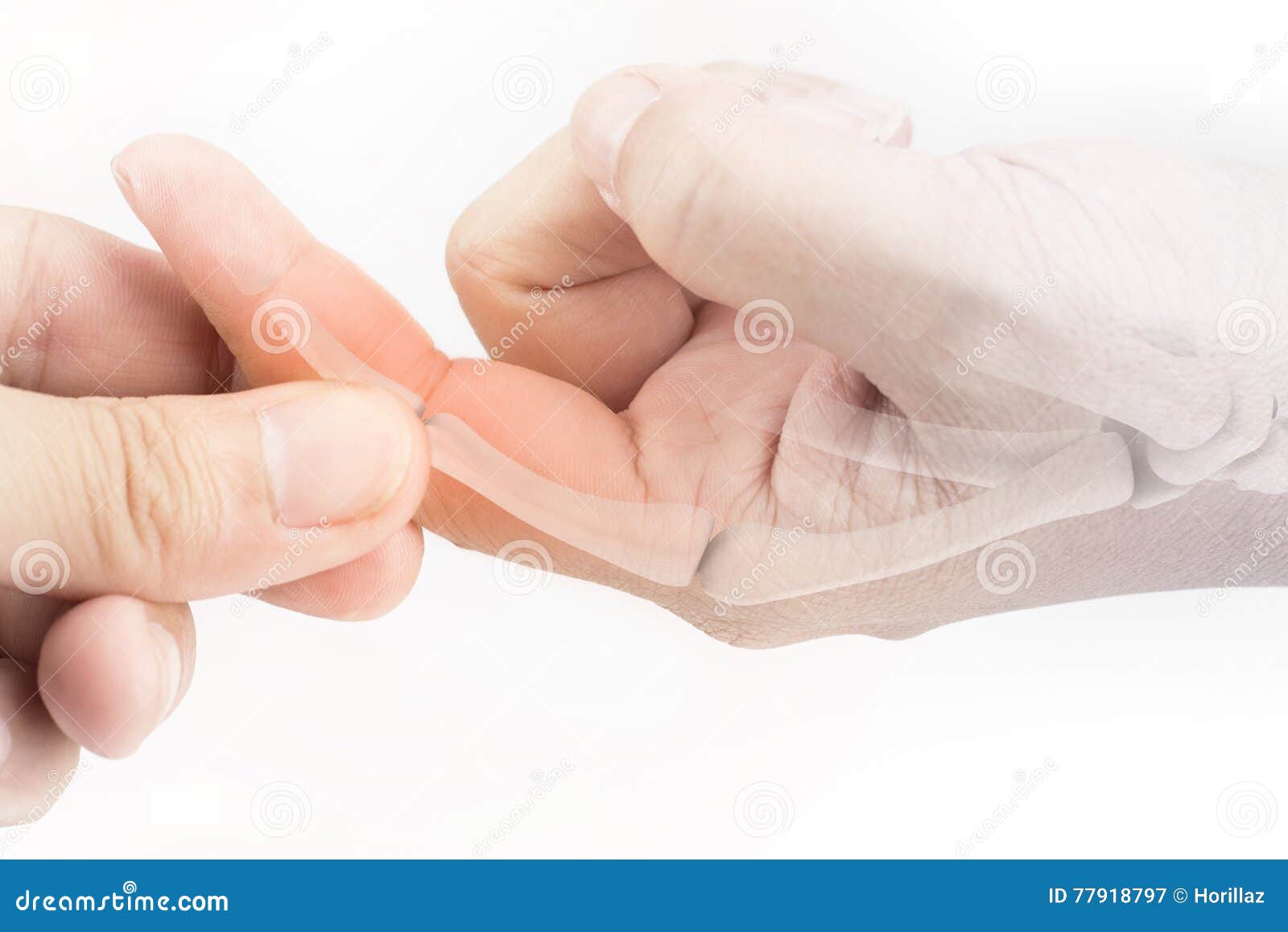 Finger bone pain stock image. Image of phalanges, chronic 77918797