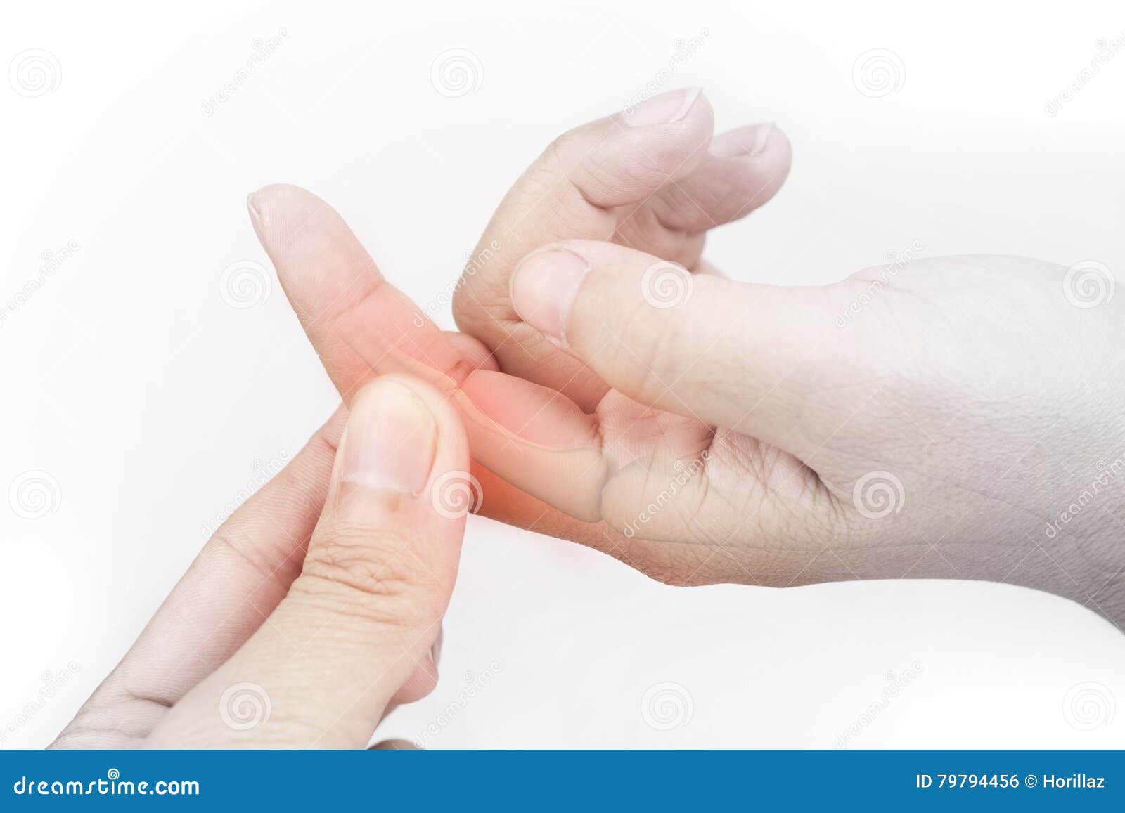 Finger bone pain stock photo. Image of calcium, bone 79794456
