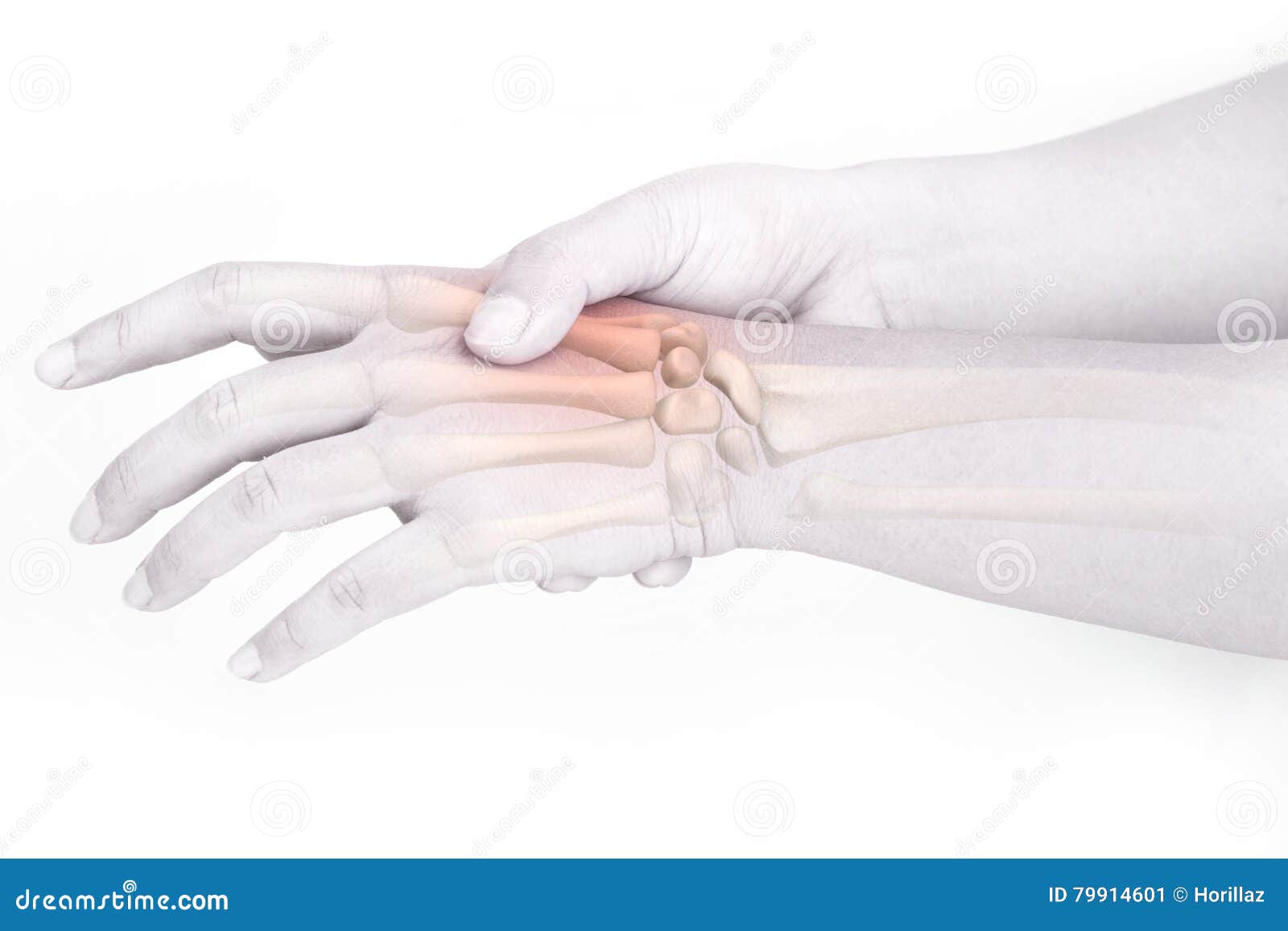 Finger bone pain stock image. Image of joints, motion 79914601