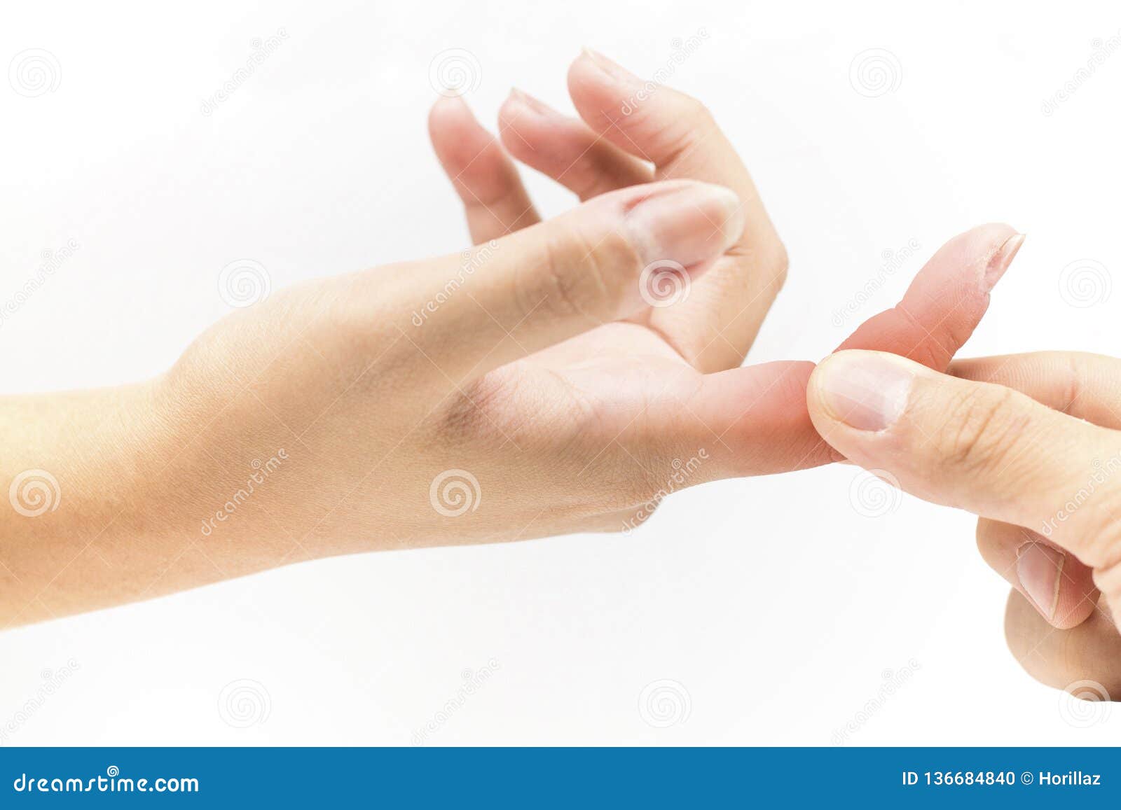 Finger bone pain stock photo. Image of motion, diseases 136684840
