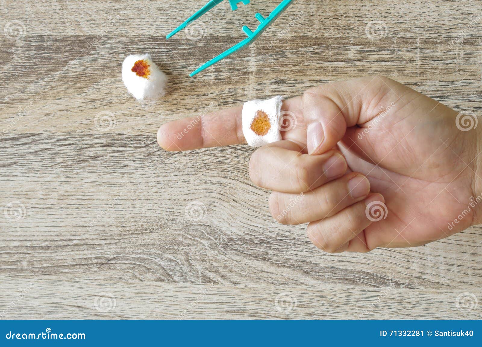 Finger first aid stock image. Image of injury, close 71332281
