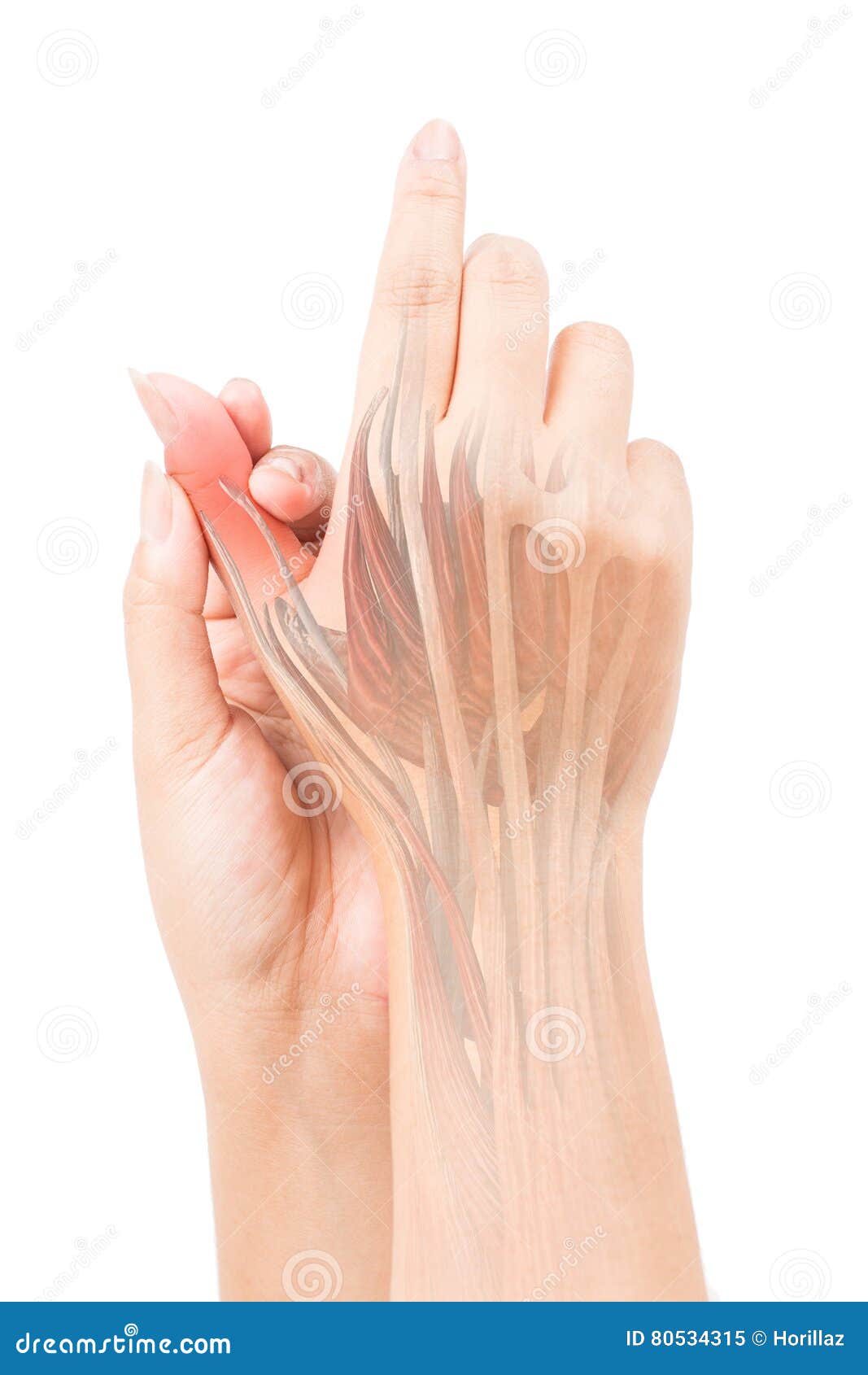 Finger muscle pain stock image. Image of inflammation 80534315
