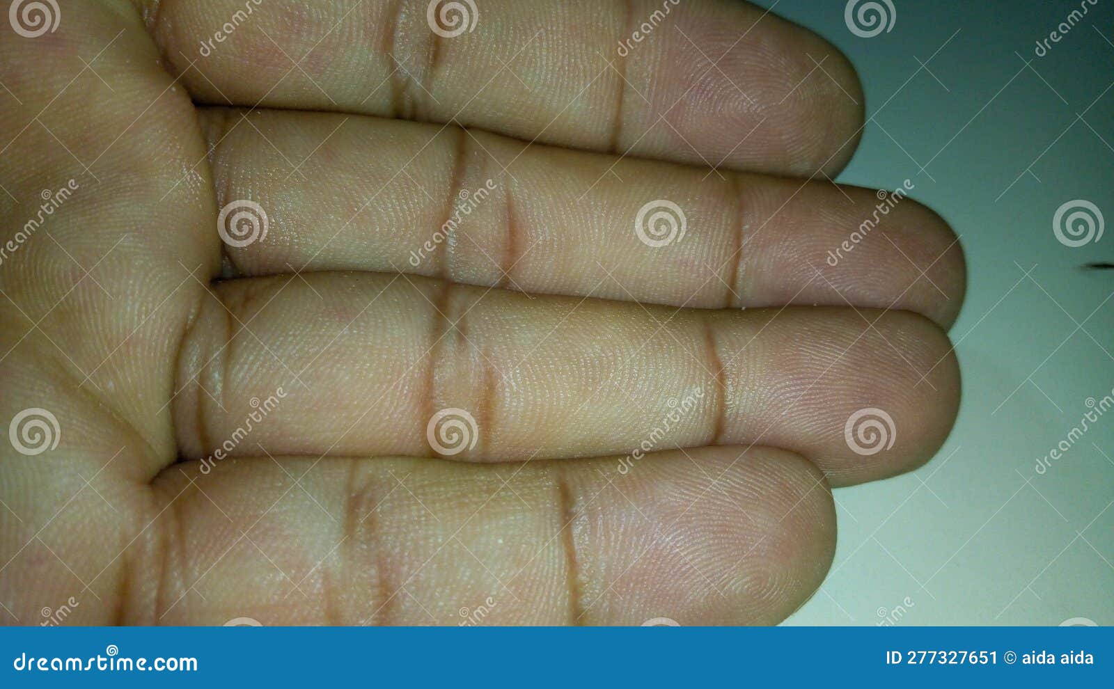 fingerprint lines that differ from person to person