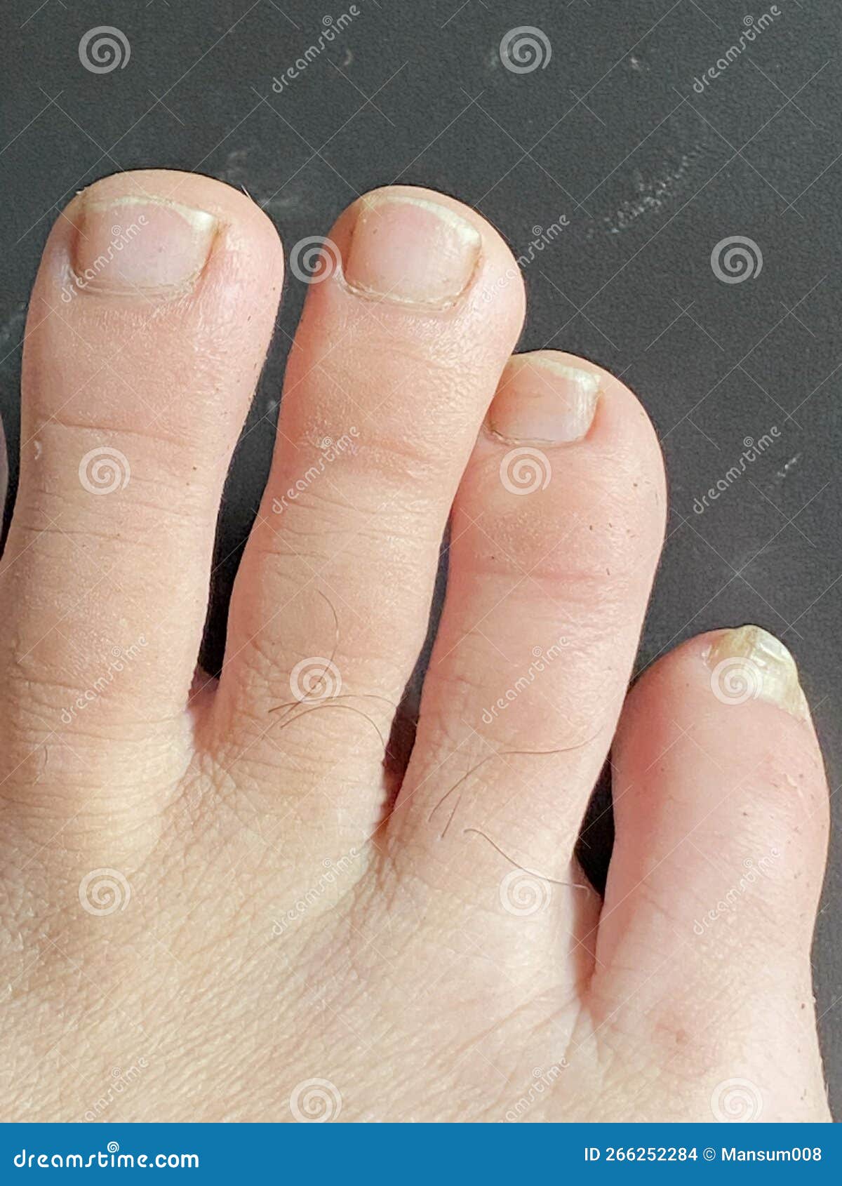 Fingers of foot stock photo. Image of foot, female, person 266252284
