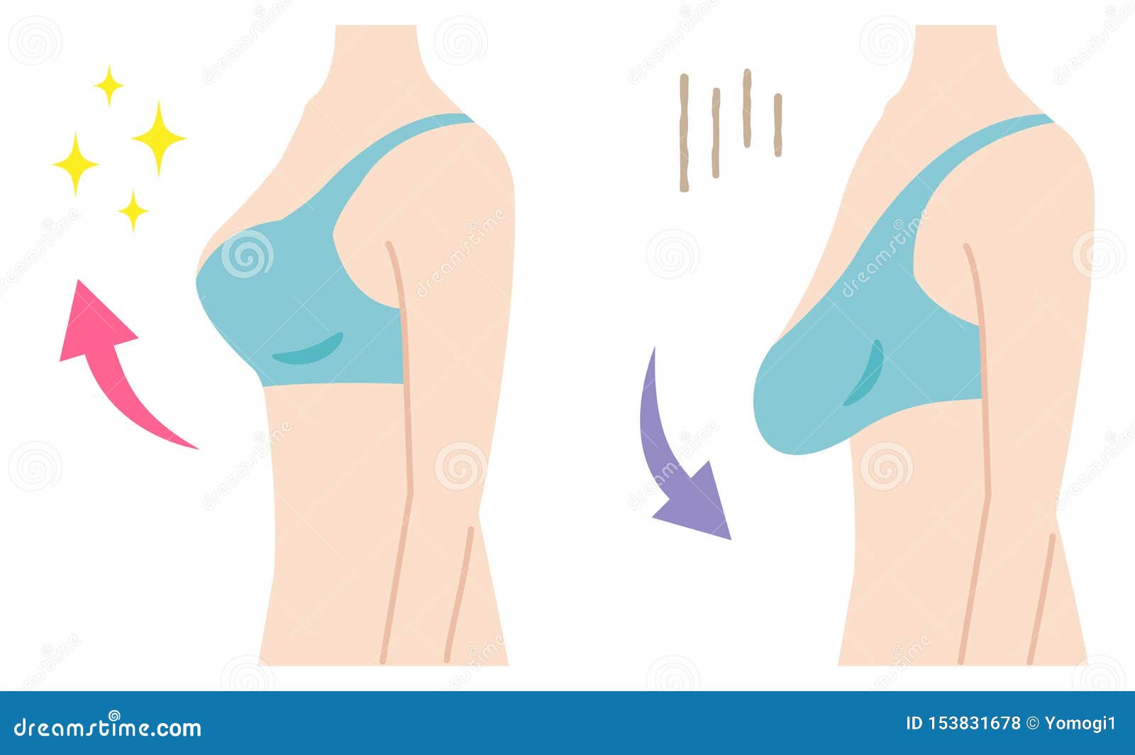 Firm and Sagging Breasts Illustration. Womenâ€™s Beauty Body Care Concept  Stock Vector - Illustration of femininity, breast: 153831678