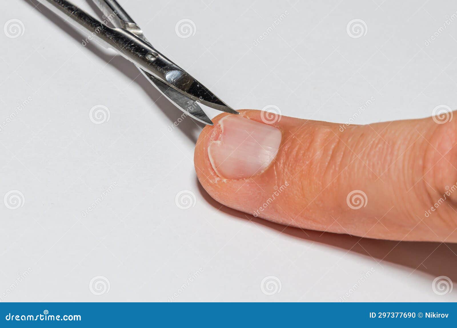 First Aid for a Patient with a Broken Fingernail Stock Photo Image of