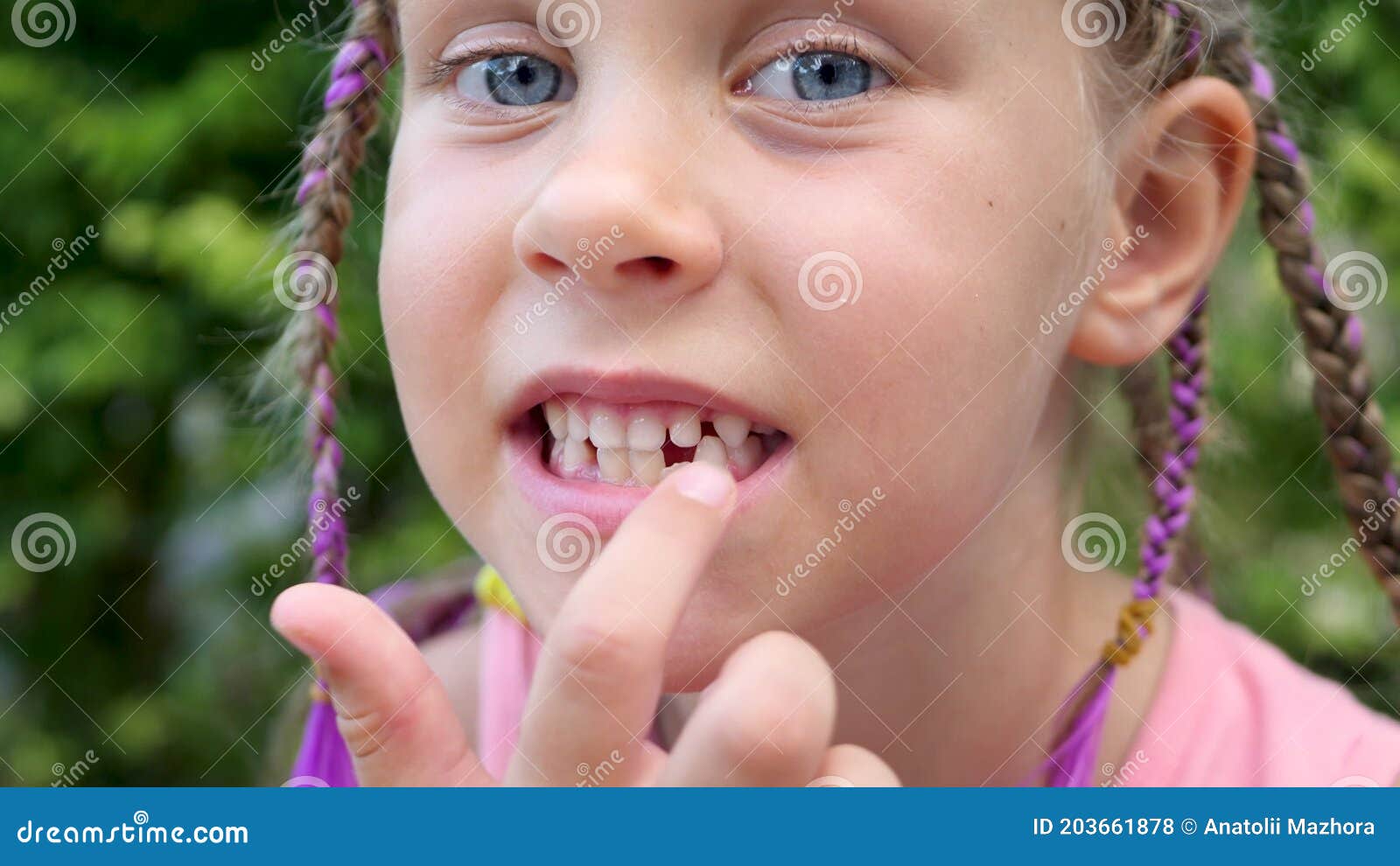 First Milk Temporary Tooth Fall Out and Change Stock Footage - Video of