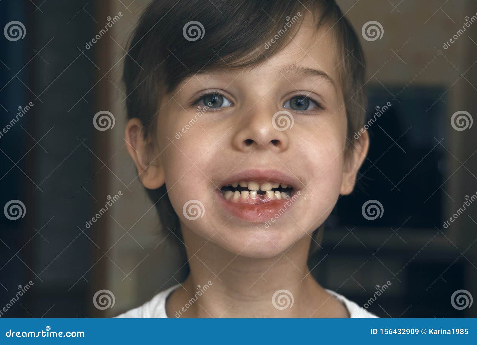 The First Milk Tooth Fell Out. Closeup Stock Image - Image of brushing