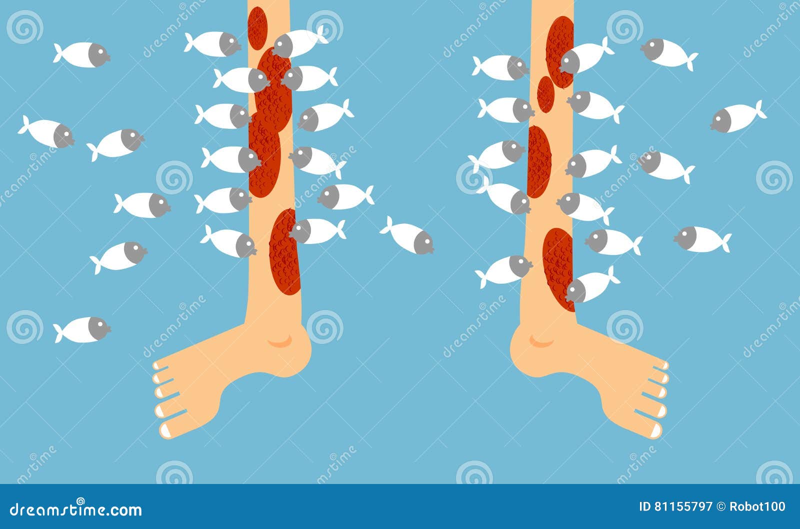 fish pedicure garra rufa