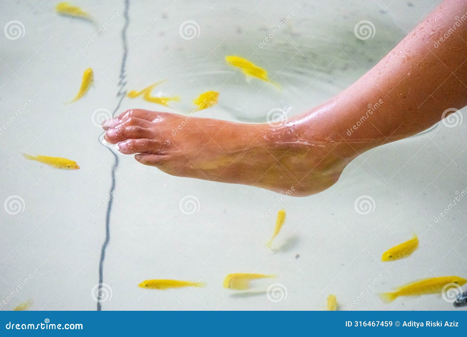 fish pedicures, also known as garra rufa therapy. this fish eats dead skin cells