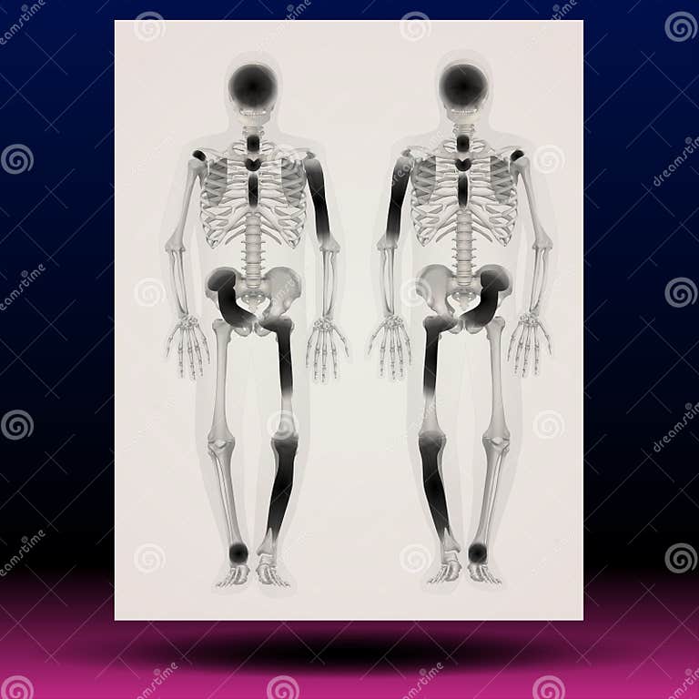 ray Illustration of a Human Skeleton Biology Diagrams