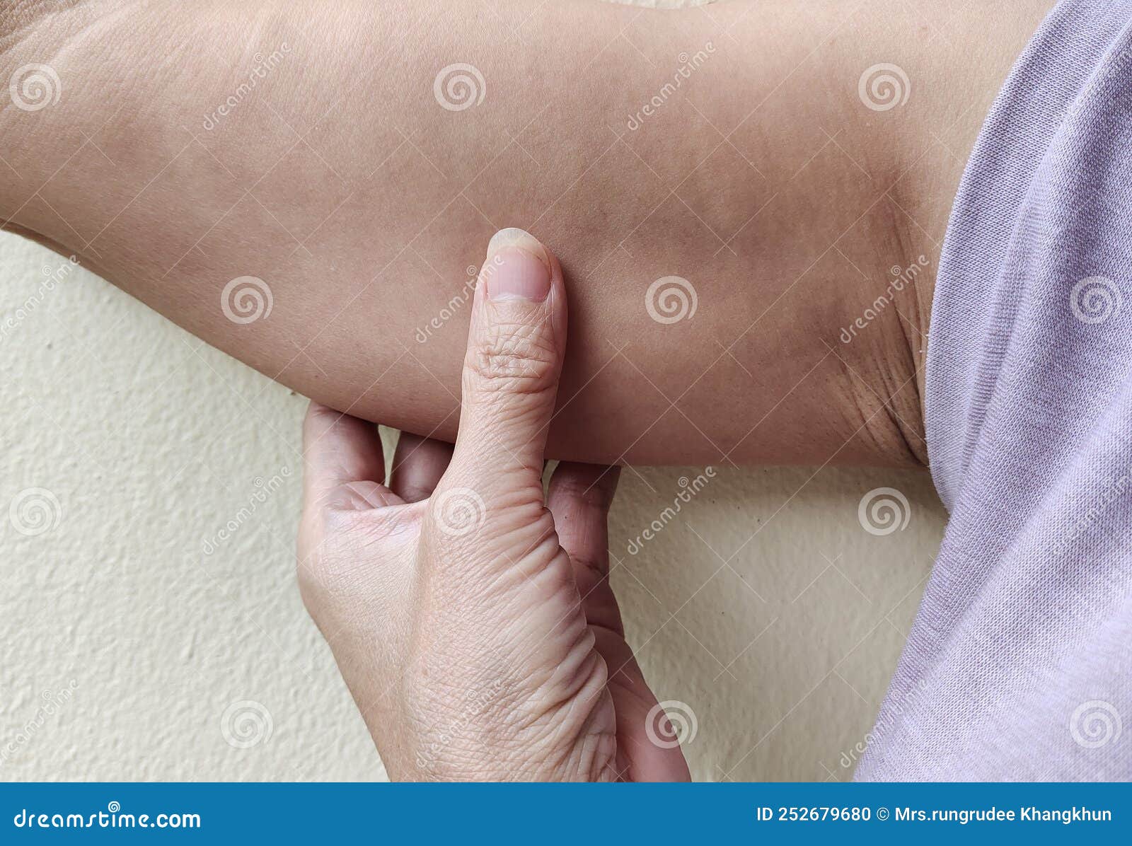 330+ Skin Condition Armpit Stock Photos, Pictures & Royalty-Free