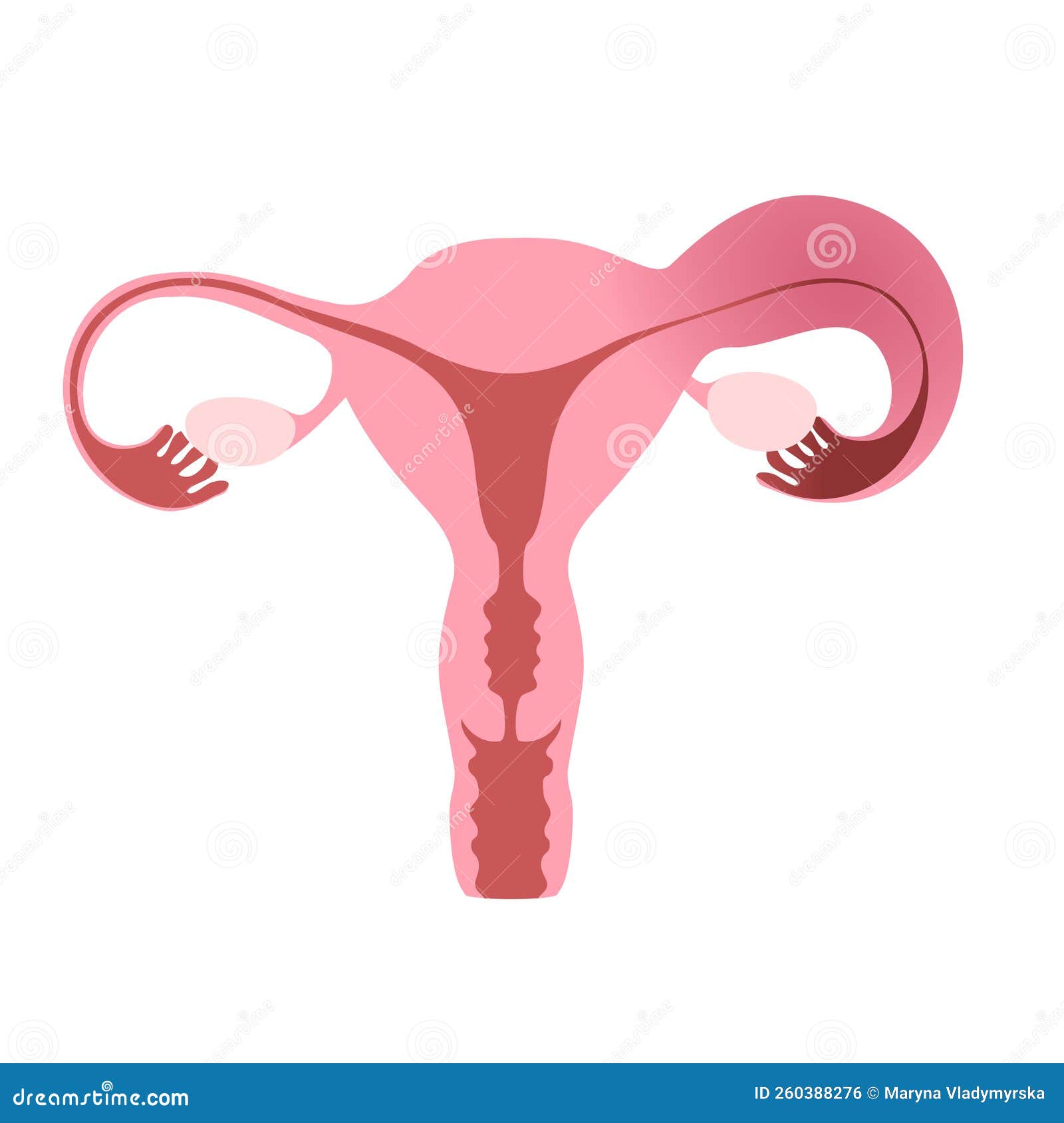 Salpingitis. Inflammation Of The Fallopian Tube. Oophoritis. Inflammation  Of The Ovary. Pelvic Organs. Infographics. Vector Illustration On Isolated  Background. Royalty Free SVG, Cliparts, Vectors, and Stock Illustration.  Image 68281130.