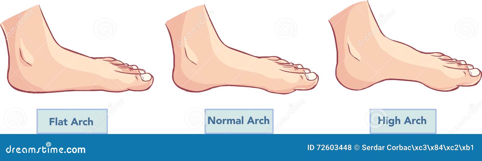 Flat and normal feet stock vector. Illustration of foot 72603448